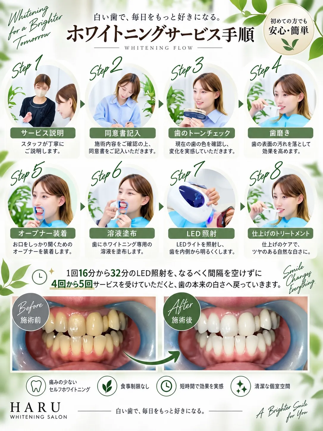 ホワイトニングの手順